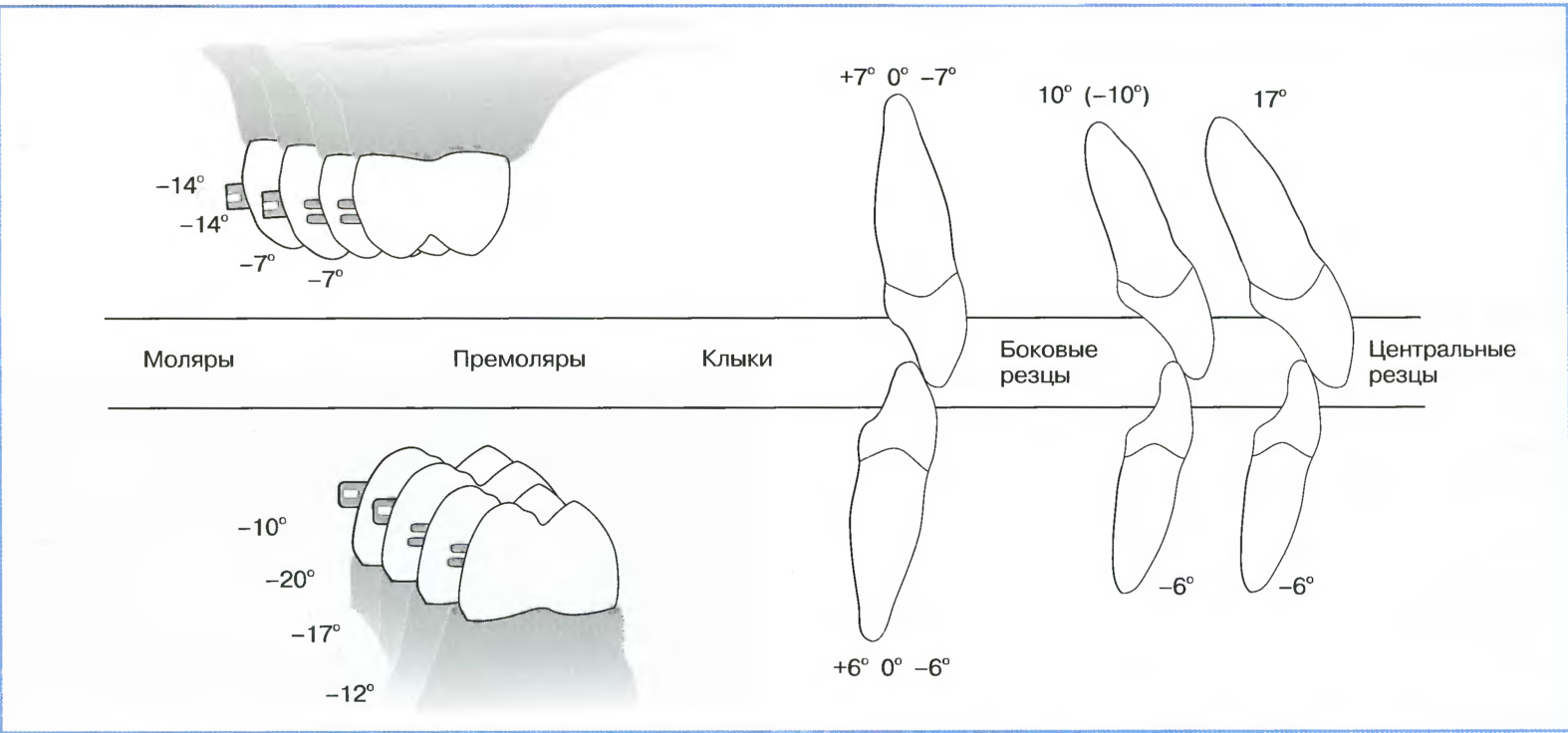 Торк коронки зуба